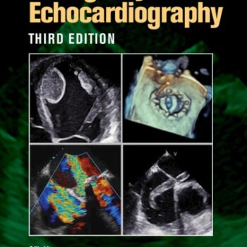 Ebook Emergency Echocardiography cheap pdf