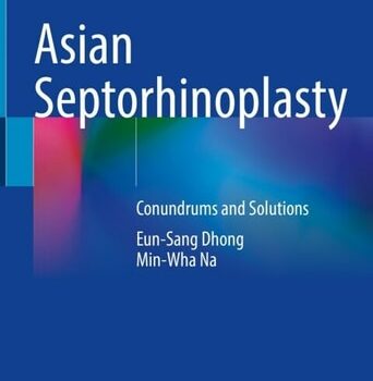 Ebook Asian Septorhinoplasty cheap pdf