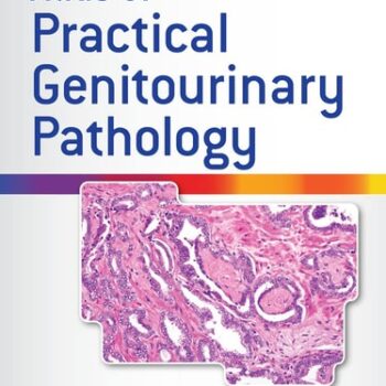 Ebook Atlas of Practical Genitourinary Pathology cheap pdf