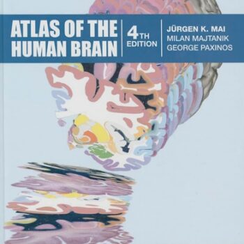 Ebook Atlas of the Human Brain cheap pdf