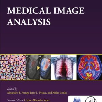 Ebook Medical Image Analysis cheap pdf Ebook Medical Image Analysis cheap pdf