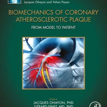 Ebook Biomechanics of Coronary Atherosclerotic Plaque: From Model to Patient (ISSN) cheap pdf