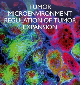 Ebook Tumor Microenvironment Regulation of Tumor Expansion cheap pdf