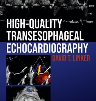 Ebook High-Quality Transesophageal Echocardiography cheap pdf