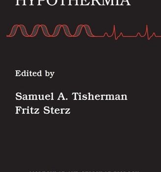 Ebook Therapeutic Hypothermia (Molecular & Cellular Biology of Critical Care Medicine Book 4) cheap pdf