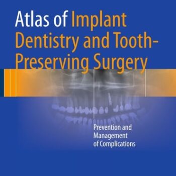 Ebook Atlas of Implant Dentistry and Tooth-Preserving Surgery: Prevention and Management of Complications cheap pdf