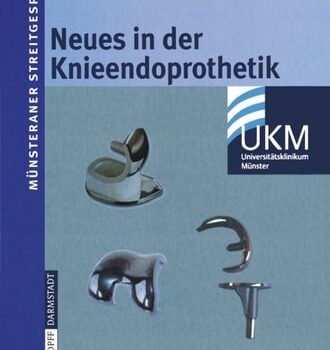 Ebook Neues in der Knieendoprothetik cheap pdf