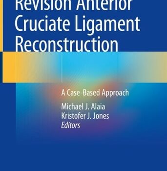 Ebook Revision Anterior Cruciate Ligament Reconstruction cheap pdf