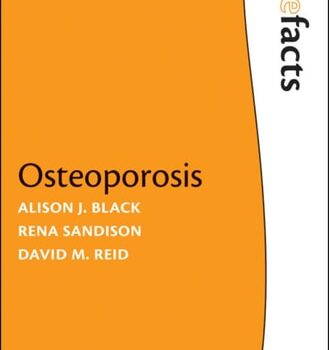 Ebook Osteoporosis: The Facts cheap pdf