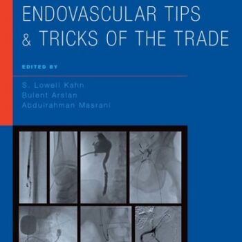 Ebook Interventional and Endovascular Tips and Tricks of the Trade cheap pdf