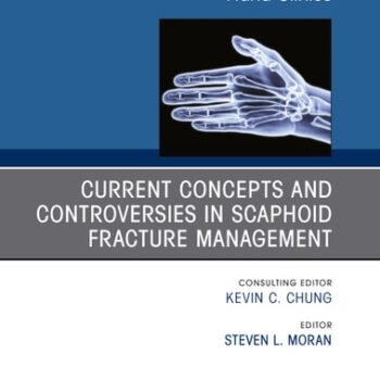 Ebook Current Concepts and Controversies in Scaphoid Fracture Management, An Issue of Hand Clinics cheap pdf