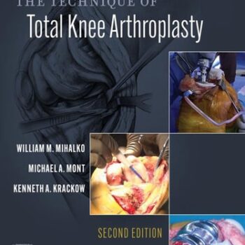 Ebook The Technique of Total Knee Arthroplasty cheap pdf