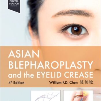 Ebook Asian Blepharoplasty and the Eyelid Crease cheap pdf