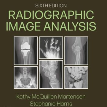 Ebook Workbook for Radiographic Image Analysis cheap pdf