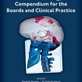 Ebook Neuro-Oncology Compendium for the Boards and Clinical Practice cheap pdf