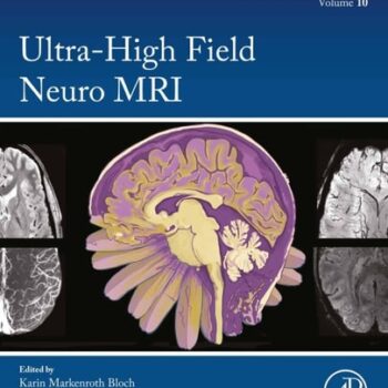 Ebook Ultra-high Field Neuro Mri cheap pdf Ebook Ultra-high Field Neuro Mri cheap pdf